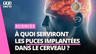 Puces implantées dans le cerveau : quelles promesses ?